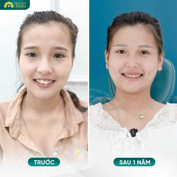 Chị Mai 