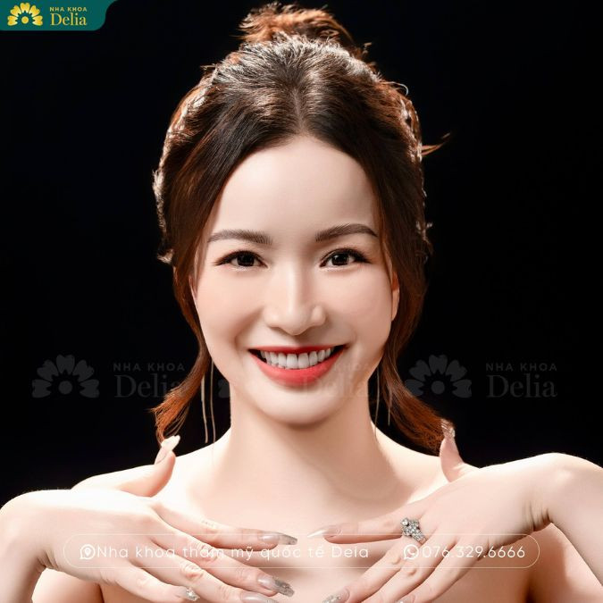 Bọc răng sứ - Sáng bừng khuôn mặt, không cần dùng app