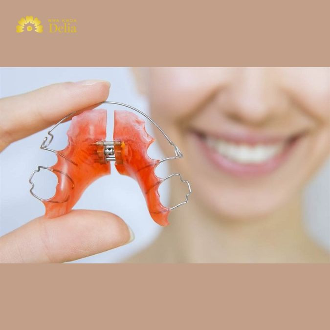 Hàm duy trì tháo lắp là một thiết bị nha khoa được thiết kế để duy trì vị trí của răng sau khi đã hoàn thành điều trị chỉnh nha