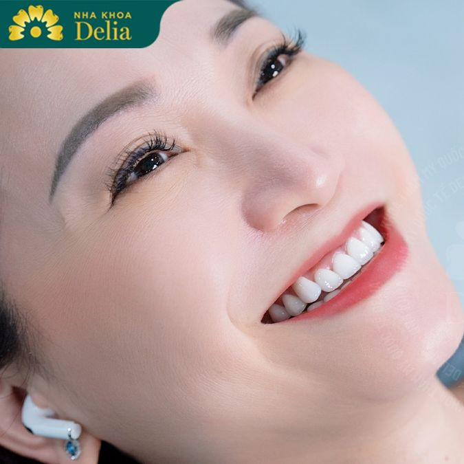 Hàm tháo lắp trên Implant giúp tăng cường tính thẩm mỹ