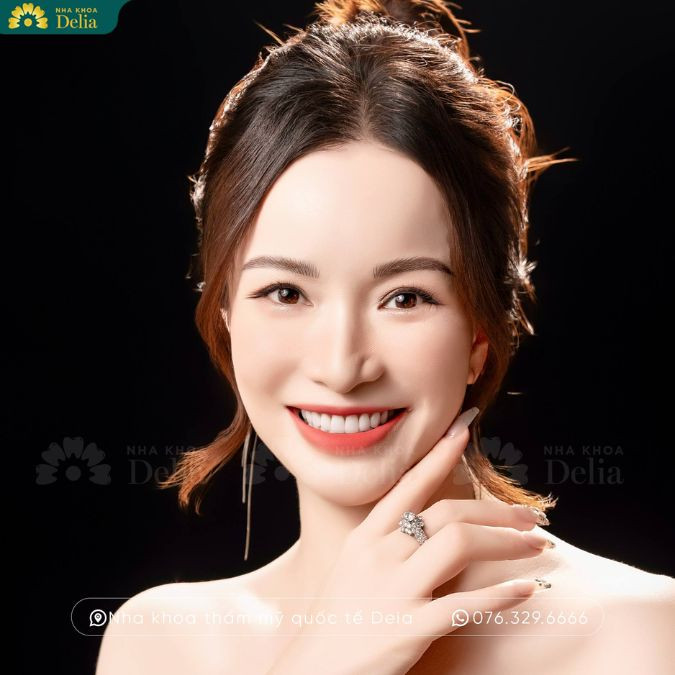 Kể từ khi làm hàm tháo lắp trên Implant tại nha khoa Delia, tôi không còn cảm thấy khó chịu khi ăn uống