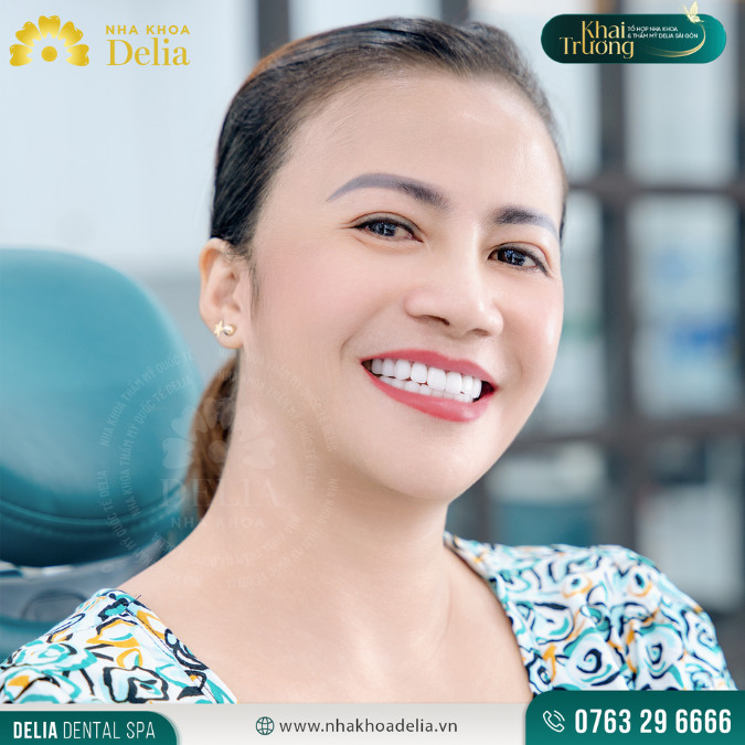 Kể từ khi trồng Implant tại Delia, tôi cảm thấy tự tin hơn rất nhiều