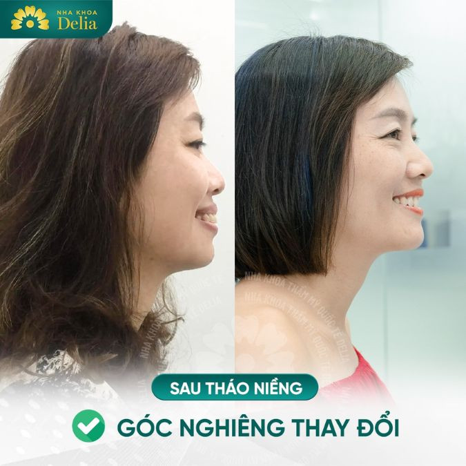 Chị Mỹ Hạnh