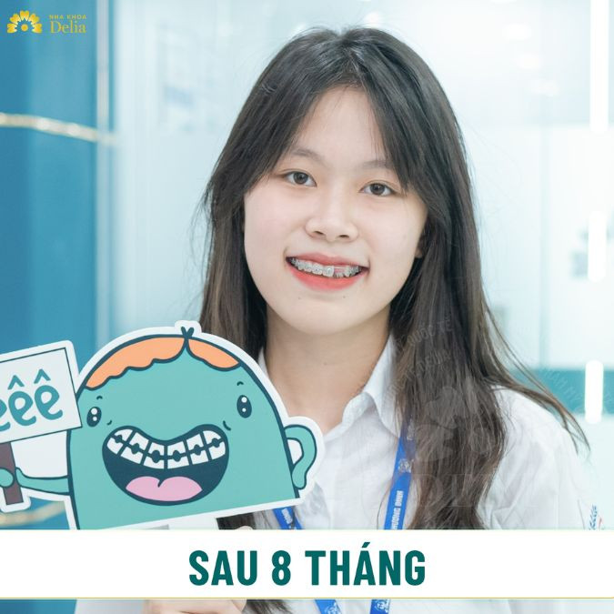 nha khoa Delia cung cấp các dịch vụ niềng răng sử dụng công nghệ tiên tiến và đội ngũ bác sĩ chỉnh nha chuyên nghiệp, giàu kinh nghiệm