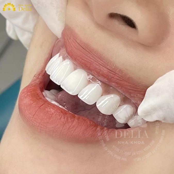 Delia đã giúp hàng ngàn khách hàng, trong đó có nhiều nghệ sĩ nổi tiếng, tự tin hơn với hàm răng trắng sáng, đều đẹp