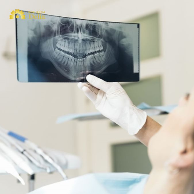 Thăm khám nha khoa định kỳ để phát hiện sớm các vấn đề liên quan đến răng giả