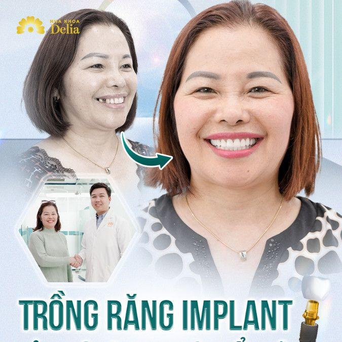 Việt kiều Canada trồng răng Implant tại Việt Nam địa chỉ nào uy tín?
