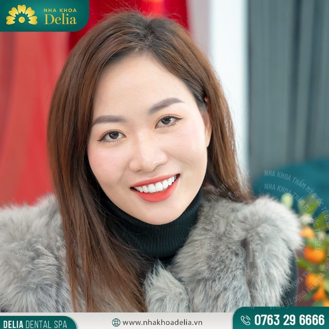 Bọc răng sứ là một giải pháp nhanh chóng và hiệu quả để cải thiện thẩm mỹ cho hàm răng