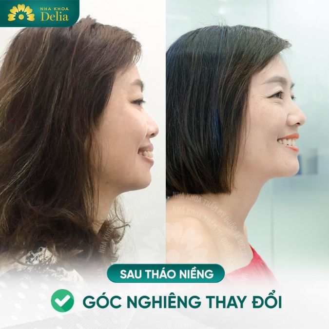 Chị Thu Hà