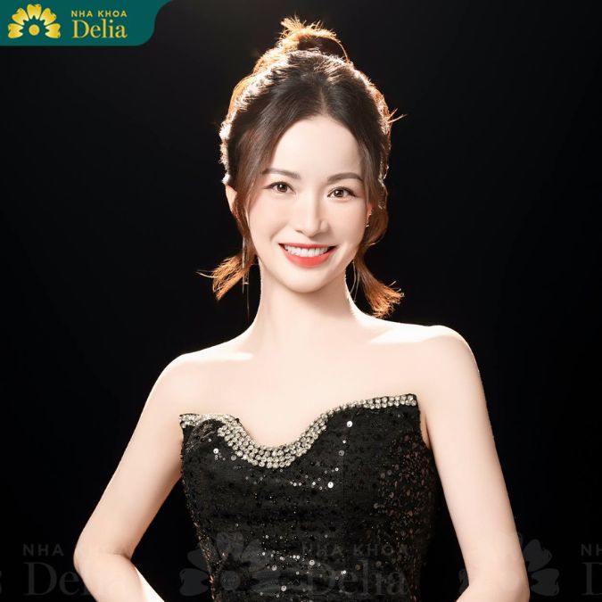 Chị Kiều Trinh - Thẩm mỹ răng sứ Emax