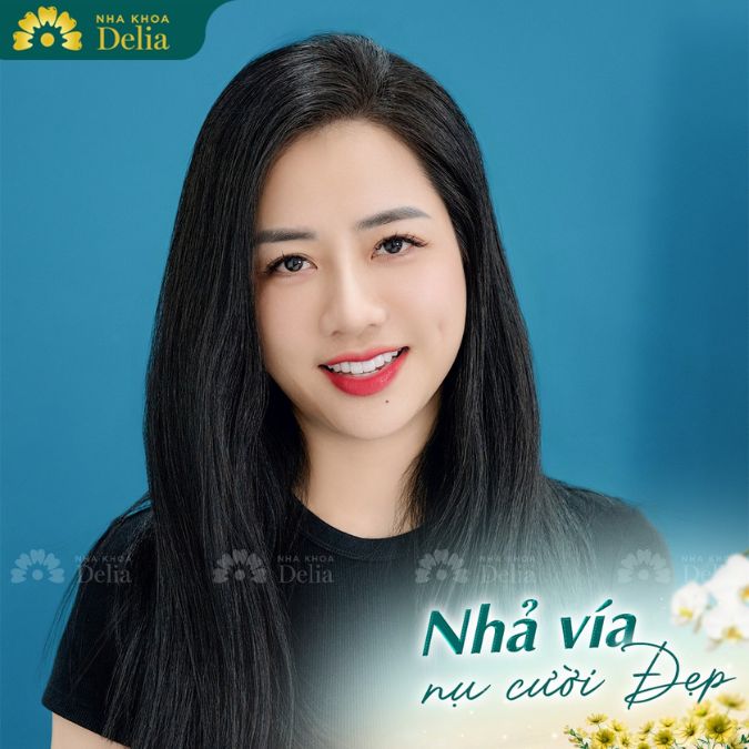 Chị Vân Anh - Thẩm mỹ răng sứ Ceramill