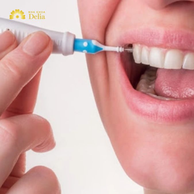 Đặt bàn chải theo góc phù hợp để nó có thể trượt vào kẽ răng một cách nhẹ nhàng