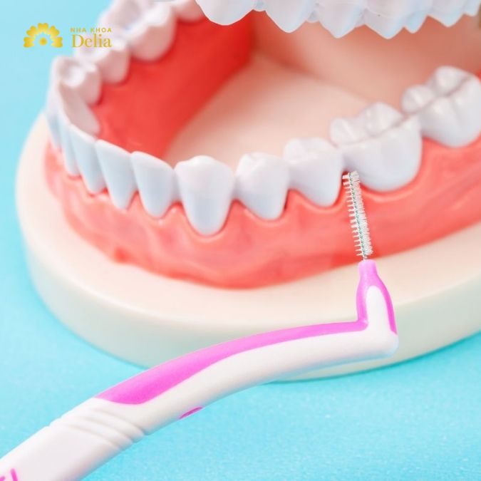 Top 7 loại bàn chải kẽ răng tốt nhất răng miệng sạch khuẩn 99.99%