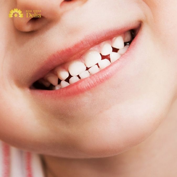 Sự mọc chậm của răng vĩnh viễn ở trẻ có thể do nhiều nguyên nhân khác nhau