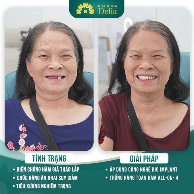 Cô Nguyễn Thị Thạch