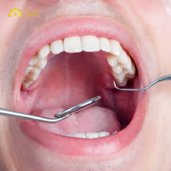Nhổ răng số 7, giống như nhổ bất kỳ răng nào khác, là một thủ tục phổ biến và an toàn khi được thực hiện bởi nha sĩ chuyên nghiệp.
