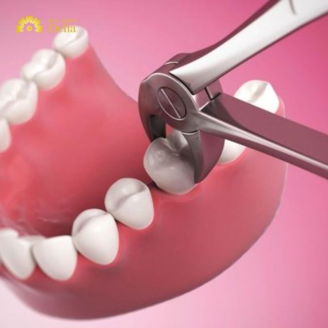 Và nhổ răng vĩnh viễn hoàn toàn không đau như nhiều người lầm tưởng.