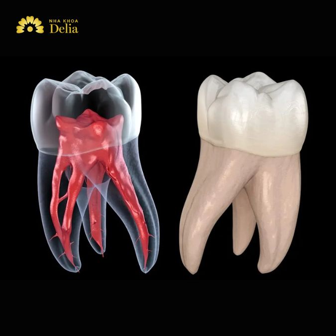 Răng số 7, hay còn gọi là răng hàm thứ hai, thường có 2 đến 3 ống tủy.