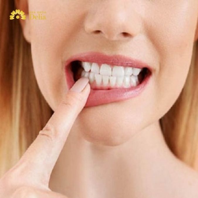 Răng vĩnh viễn bị lung lay có thể do nhiều nguyên nhân khác nhau gây ra