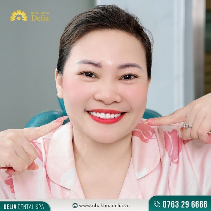 Răng tôi giờ đây không những thẳng tắp mà còn không còn lung lay nữa. Cảm ơn đội ngũ tại Delia đã giúp tôi lấy lại nụ cười tự tin