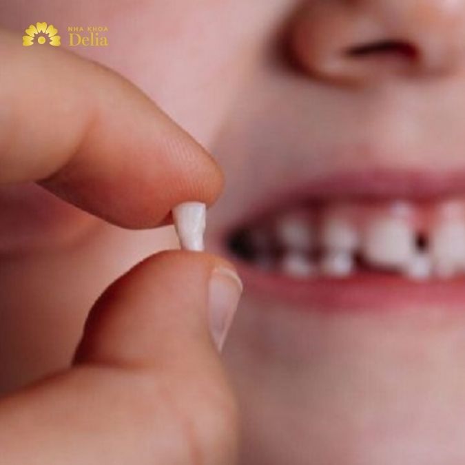 Khi răng sữa của trẻ lung lay, thông thường không nên nhổ ngay vì răng có thể tự rụng