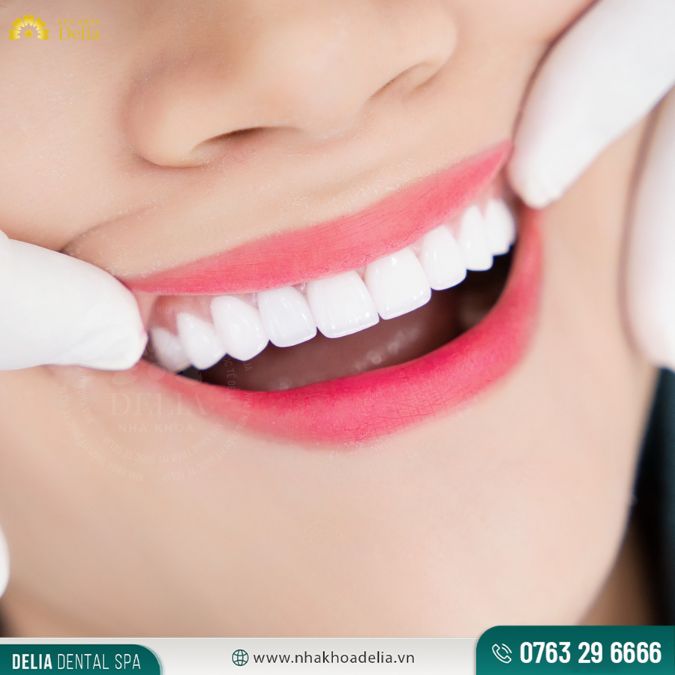 Răng sứ Cercon được biết đến với độ bền cao và tính thẩm mỹ tự nhiên