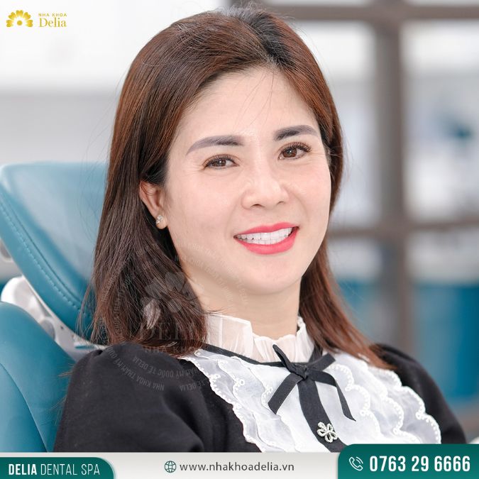 Đổi răng sứ cũ - Lấy sứ mới - Duy nhất 20 suất 