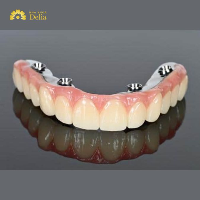 Comparing Costs with Other Dental Procedures