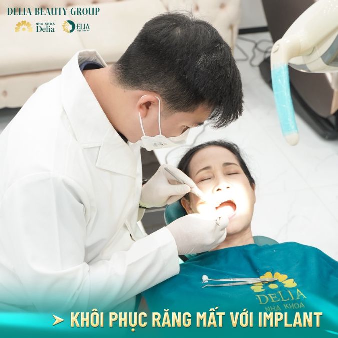 Chia sẻ danh sách bác sĩ cấy ghép Implant giỏi ở Hà Nội