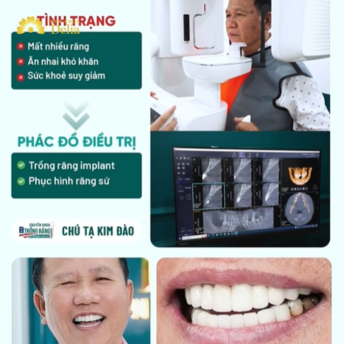 Phác đồ điều trị phù hợp cho chú Đào, bao gồm việc trồng răng implant vào các vị trí răng mất và phục hình răng sứ