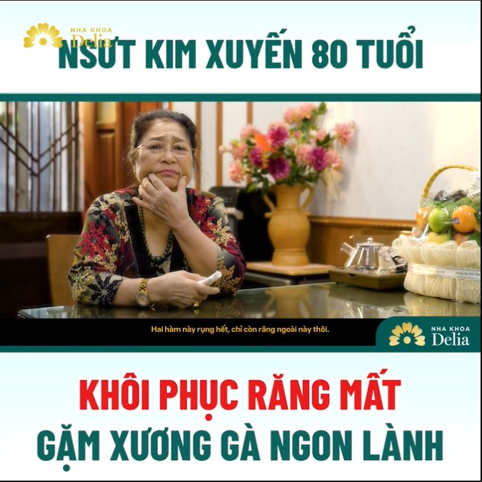 Cô Kim Xuyến có chia sẻ với nha khoa Delia về tình trạng mất rất nhiều răng hàm và mất đã nhiều răng