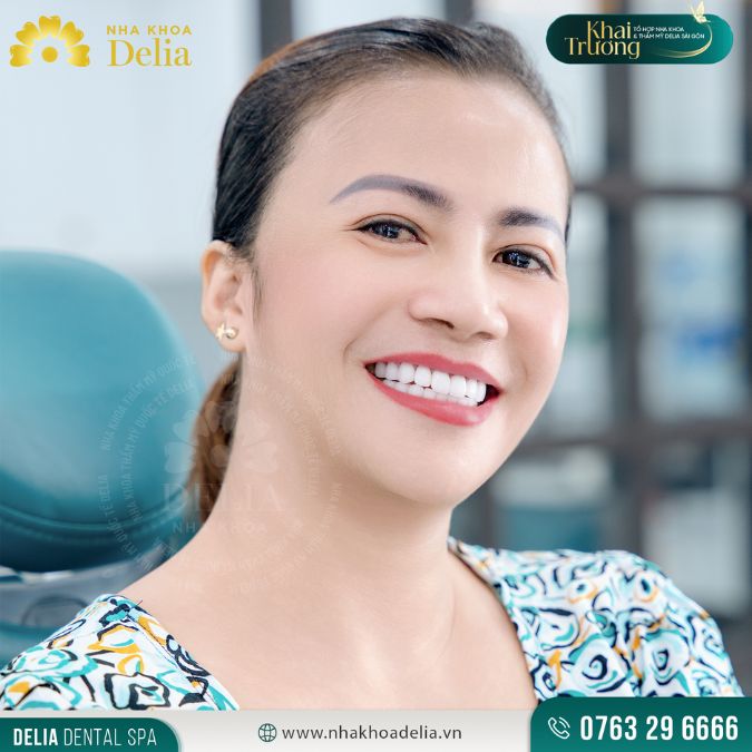 Advantages of immediate all on 4 dental Implants