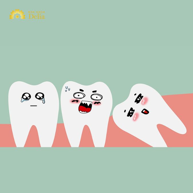 Răng khôn, còn được gọi là răng cối lớn thứ ba, là những chiếc răng cuối cùng trong chuỗi phát triển răng của con người.