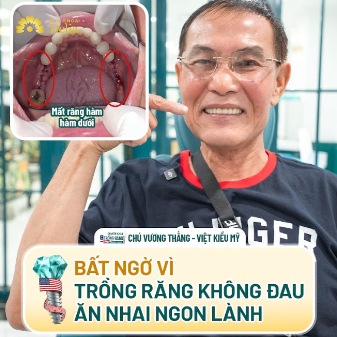 KH Vương Thắng bất ngờ vì trồng răng Implant không đau, ăn nhai ngon lành