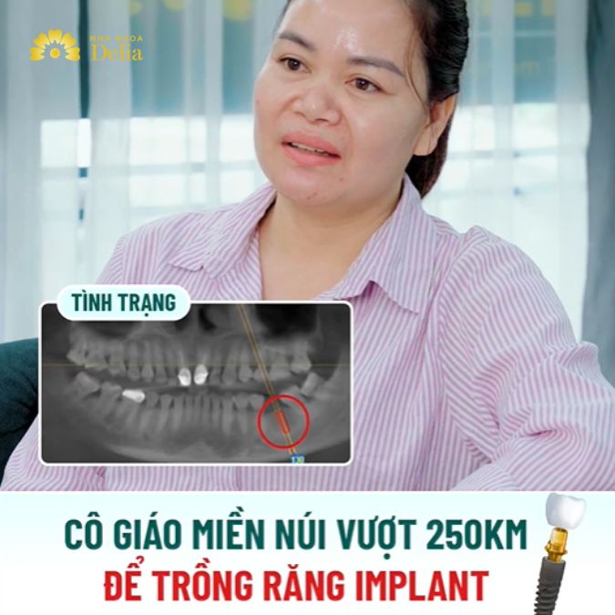 Tình trạng mất răng khá nghiêm trọng của cô giáo trẻ