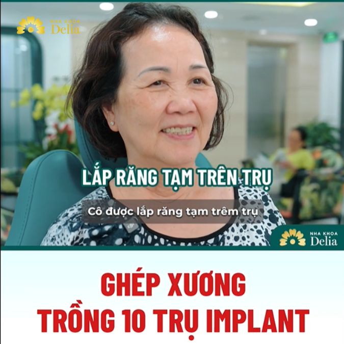 Phục hồi khả năng ăn nhai tức thì sau trồng răng Implant