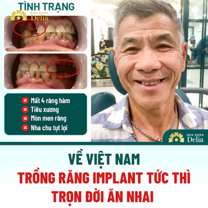 Tình trạng mất răng của chú Phú