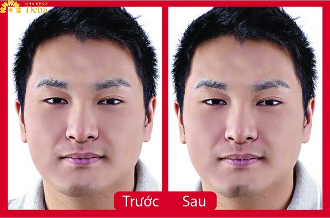 Anh Hà (35 tuổi, Đà Nẵng)
