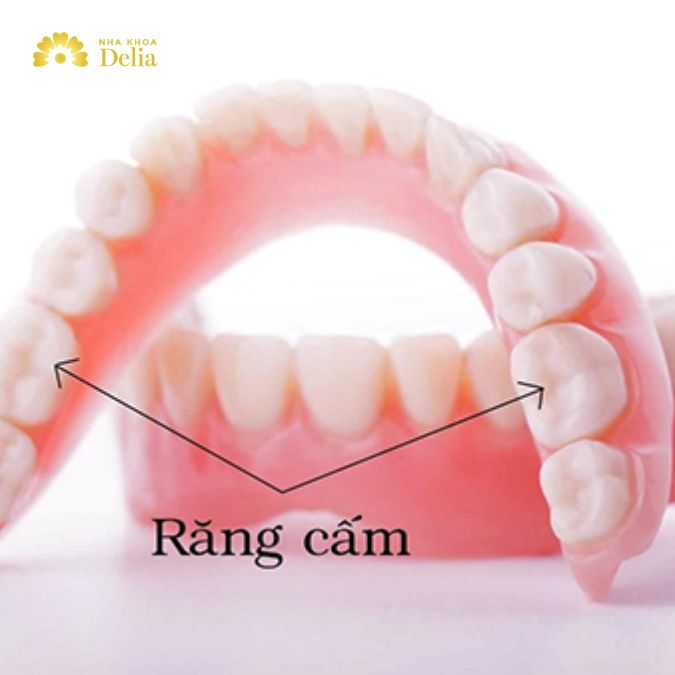 Răng cấm là các răng nằm ở phía trong cùng của hàm, có vai trò quan trọng trong việc nhai và nghiền thức ăn