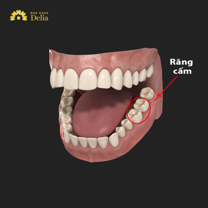 Răng cấm là những chiếc răng nằm ở phía trong cùng của hàm răng