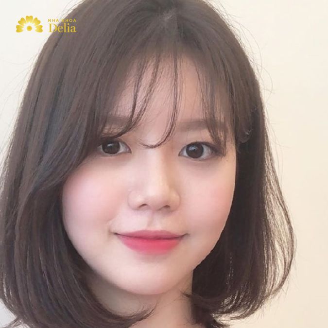 Khuôn mặt tròn thường được đặc trưng bởi độ dài và độ rộng của mặt tương đối tương đồng