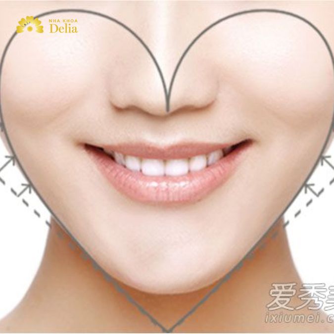 Khuôn mặt hình trái tim có đặc điểm trán rộng và cằm nhọn.