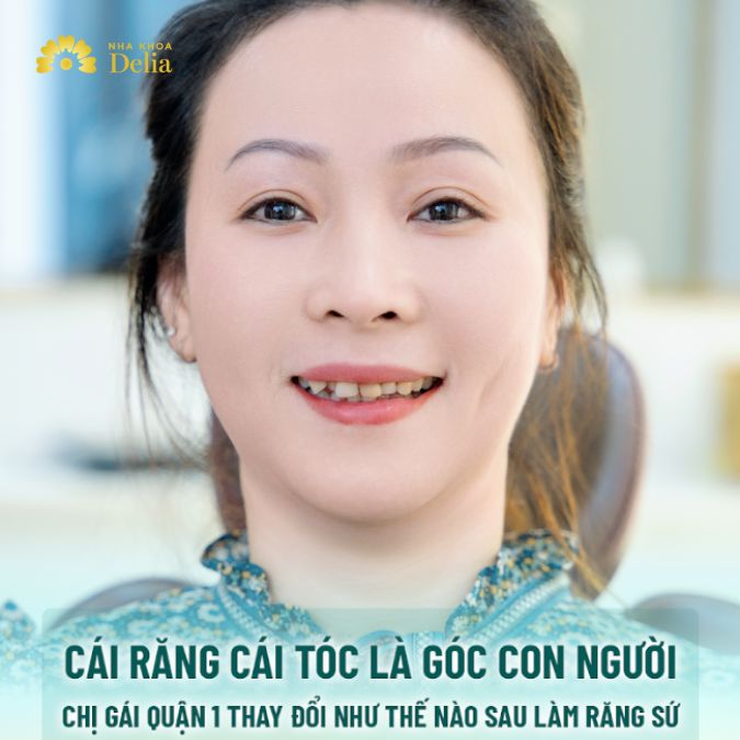 Nhiều năm không thể tự tin nở nụ cười