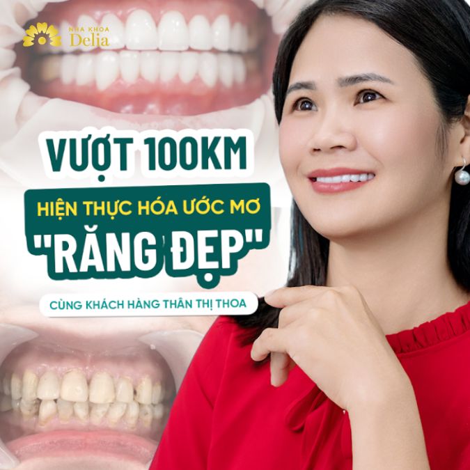 Vượt 1000km hiện thực hóa ước mơ răng đẹp - Chị Thân Thị Hoa