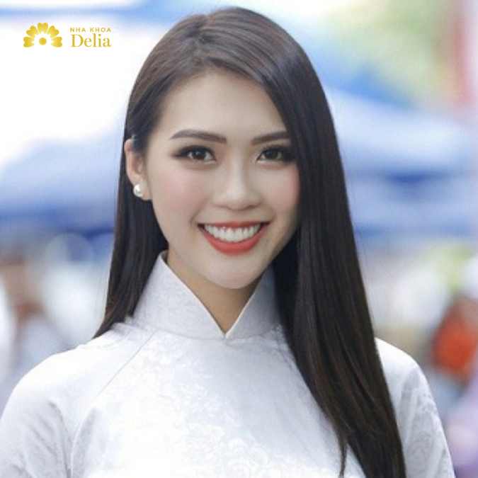 Phụ nữ cười hở lợi có tốt không?