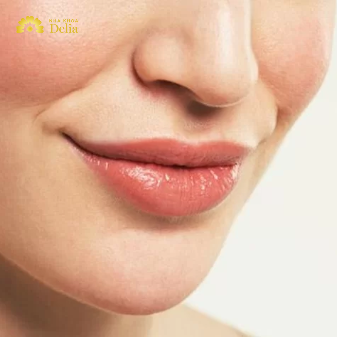 Khuôn miệng cười không đẹp là như thế nào, cải thiện có dễ không?