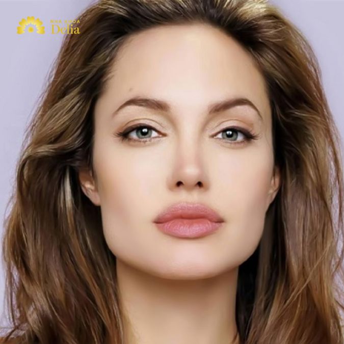 Dáng môi rộng có chiều ngang của môi lớn hơn so với bình thường
