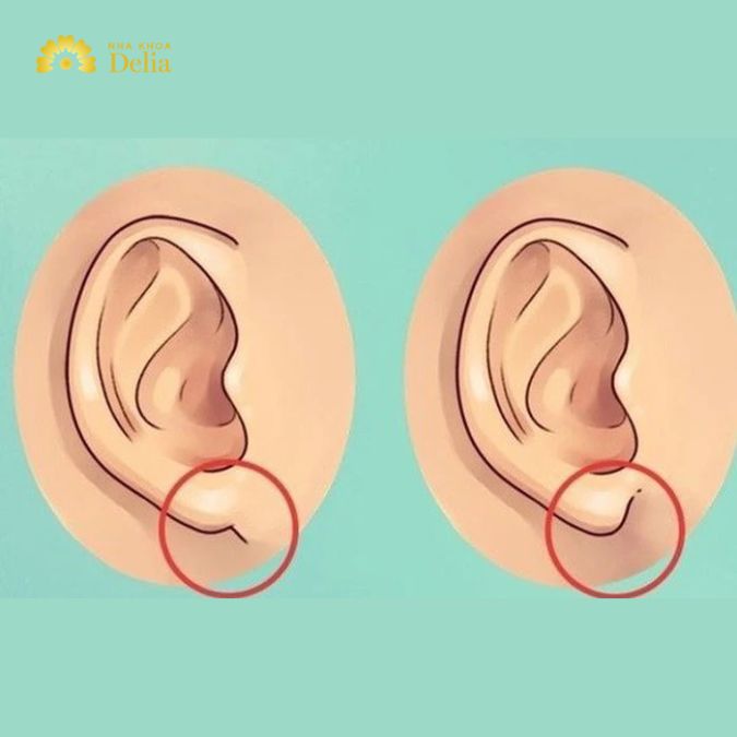 Tai trong nhân tướng học không chỉ liên quan đến khả năng nghe mà còn liên quan đến sức khỏe và tuổi thọ
