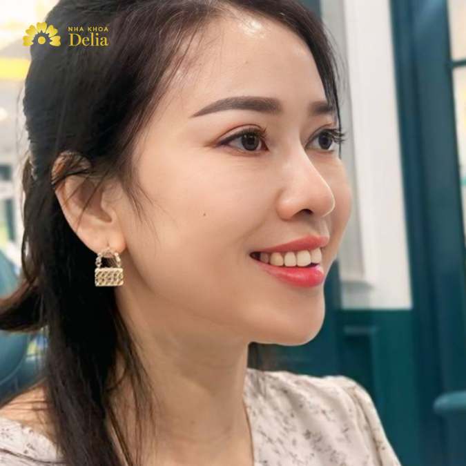 Chị Oanh trước đây luôn cảm thấy thiếu tự tin về hàm răng của mình.