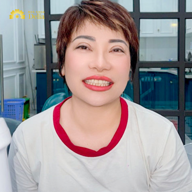 Cô Hằng không hài lòng với hàm răng của mình vì chúng xỉn màu và hơi đen